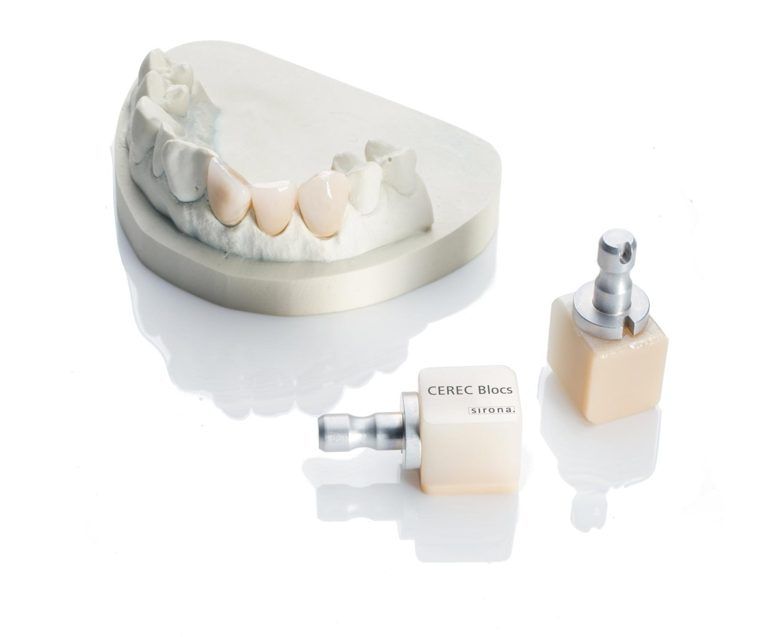 People Watching CEREC Making a Dental Restoration